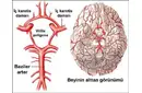 Beyinde Kılcal Damar Tıkanıklığı Belirtileri ve Tedavisi