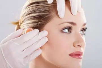 Yüzde Kılcal Damar Çatlaması Belirtileri ve Tedavisi